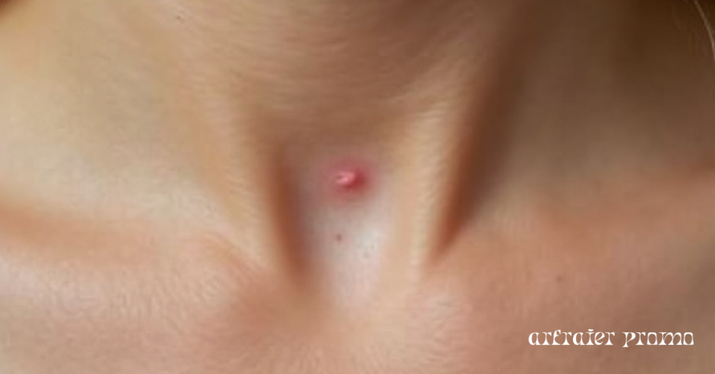 a small skin tag on the neck