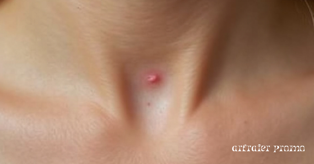 What Is Tagged Skin? Symptoms, Reasons, and Treatment Options